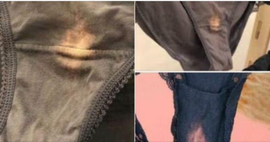 This is what it means if you find a “bleach” spot on your underwear